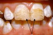 Anomalii dentare de formă, structură și mărime