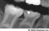 Anomalii dentare de formă, structură și mărime